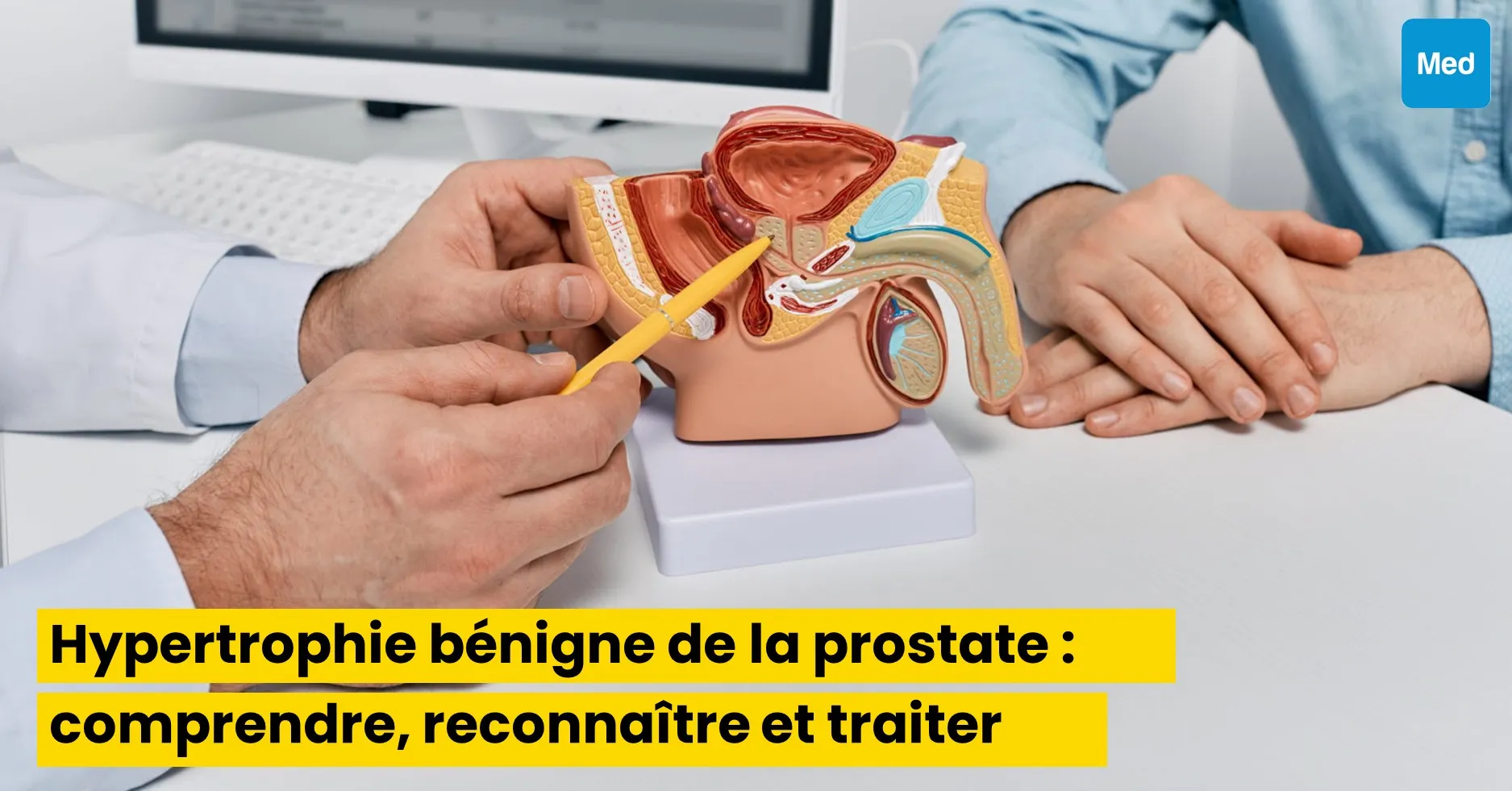 Hypertrophie bénigne de la prostate : comprendre, reconnaître et traiter